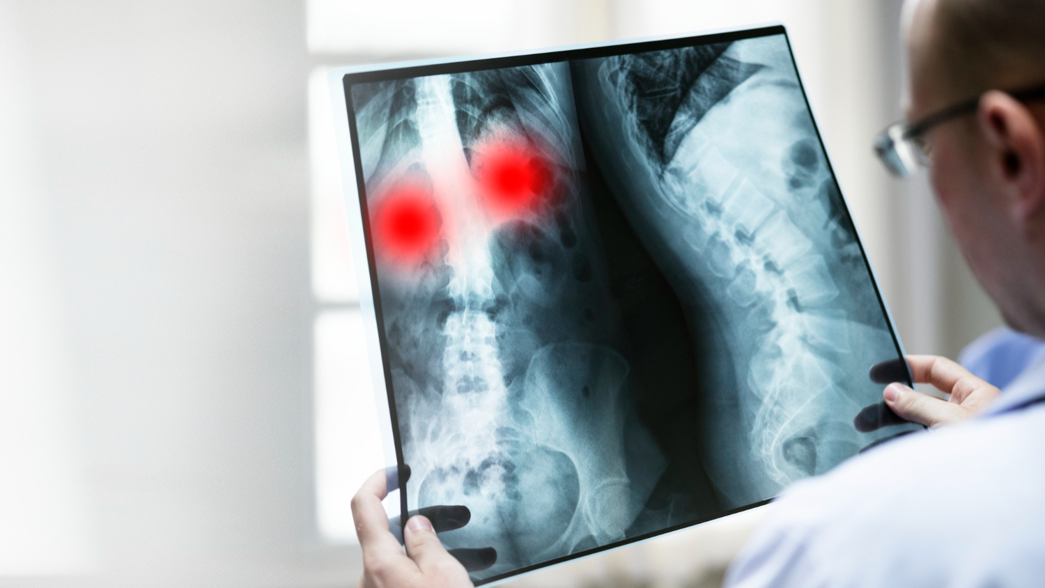 X-rays in Tiffin